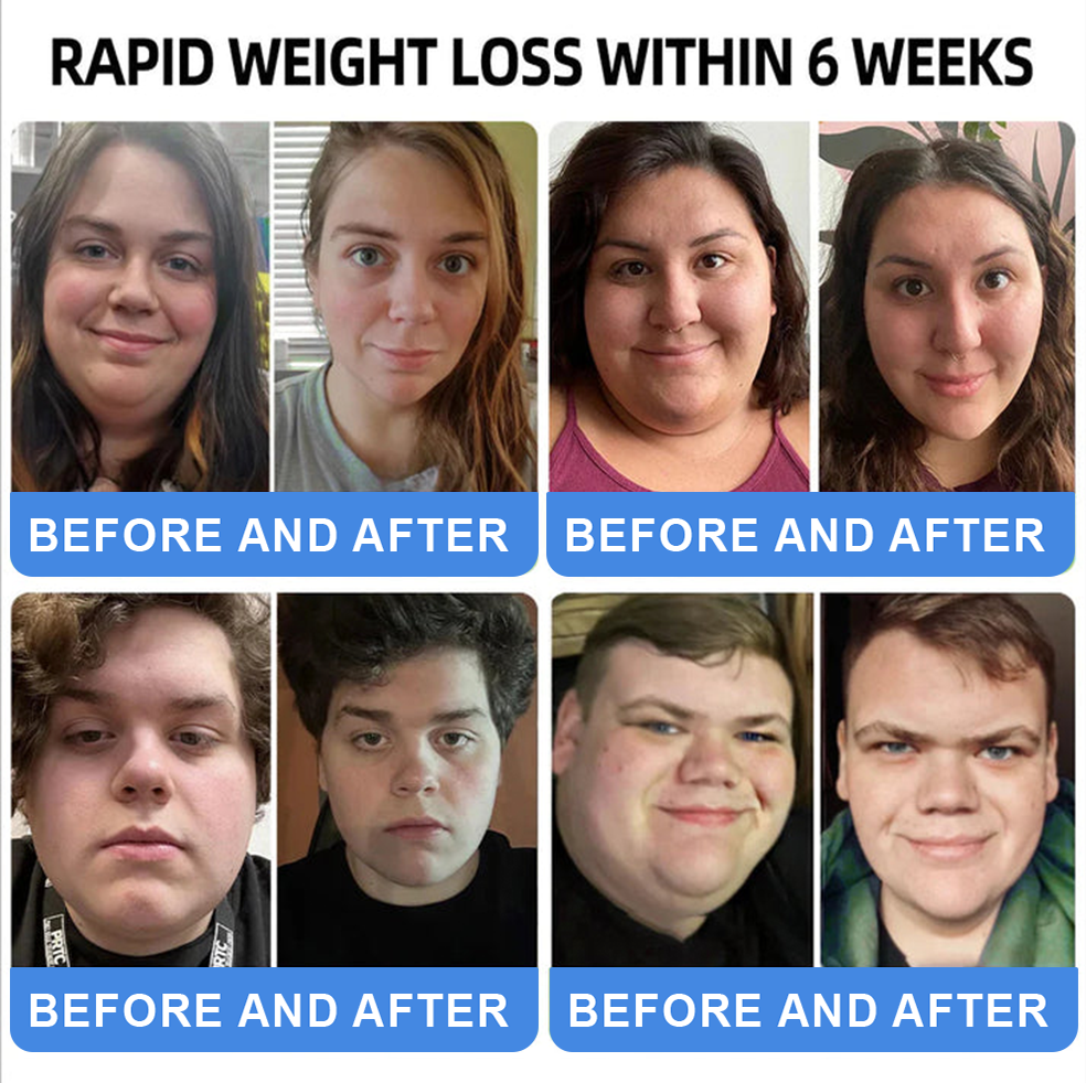 ใLast Day Promotion 66% OFFใ๐ฑ ๐ช๐๐๐๐๐ยฎ NIDDK-Tirzepatide Oral Solution โ
Use once every two days, | Lose 20 pounds quickly | Reduce sugar by 90% |)๐ฉโโ๏ธ