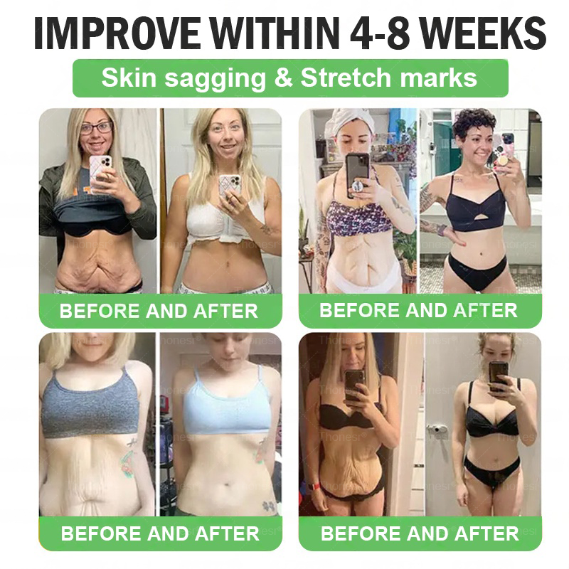 ๐ฌ๐งโจ๐ช๐๐๐๐๐๐๐๐๐ ๐ท๐๐๐๐๐ | ๐ถ๐๐๐๐๐๐๐ ๐บ๐๐๐๐ | ๐๐ก๐จ๐ง๐๐ฌ๐ซยฎ & ๐๐๐-๐ ๐ท๐๐+ ๐ถ๐๐๐ ๐พ๐๐๐๐๐ ๐ณ๐๐๐ ๐บ๐๐๐๐๐๐๐ ๐๐บ๐๐๐พ๐๐ ๐ก๐ข๐๐๐๐๐ ๐ค๐๐๐โ๐ก, โ๐๐โ ๐๐๐๐๐ ๐๐๐๐ ๐ ๐ข๐๐, ๐๐๐๐๐ ๐ ๐ข๐๐๐ ,๐ง๐ข๐ต๐ต๐บ ๐ญ๐ช๐ท๐ฆ๐ณ, ๐ ๐๐๐๐๐๐ ๐ ๐๐๐ & ๐๐๐๐ ๐๐๐ ๐๐๐ก๐ก๐๐ โ๐๐๐๐กโ & ๐ฃ๐๐ก๐๐๐๐ก๐ฆ๐๐