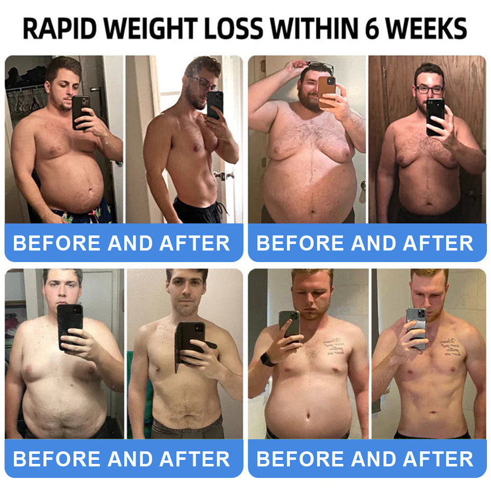 【Last Day Promotion 66% OFF】🌱 𝑪𝒗𝒓𝒆𝒐𝒛® NIDDK-Tirzepatide Oral Solution ✅Use once every two days, | Lose 20 pounds quickly | Reduce sugar by 90% |)👩‍⚕️