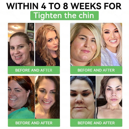 🇬🇧✨𝑪𝒍𝒊𝒏𝒊𝒄𝒂𝒍𝒍𝒚 𝑷𝒓𝒐𝒗𝒆𝒏 | 𝑶𝒇𝒇𝒊𝒄𝒊𝒂𝒍 𝑺𝒕𝒐𝒓𝒆 | 𝐓𝐡𝐨𝐧𝐞𝐬𝐫® & 𝐆𝐋𝐏-𝟏 𝑷𝒓𝒐+ 𝑶𝒓𝒂𝒍 𝑾𝒆𝒊𝒈𝒉𝒕 𝑳𝒐𝒔𝒔  𝑺𝒐𝒍𝒖𝒕𝒊𝒐𝒏 𝗍𝖺𝗋𝗀𝖾𝗍𝗌 𝑡𝑢𝑏𝑏𝑜𝑟𝑛 𝑤𝑒𝑖𝑔ℎ𝑡, ℎ𝑖𝑔ℎ 𝑏𝑙𝑜𝑜𝑑 𝑝𝑟𝑒𝑠𝑠𝑢𝑟𝑒, 𝑏𝑙𝑜𝑜𝑑 𝑠𝑢𝑔𝑎𝑟 ,𝘧𝘢𝘵𝘵𝘺 𝘭𝘪𝘷𝘦𝘳, 𝑠𝑎𝑔𝑔𝑖𝑛𝑔 𝑠𝑘𝑖𝑛 & 𝑚𝑜𝑟𝑒 𝑓𝑜𝑟 𝑏𝑒𝑡𝑡𝑒𝑟 ℎ𝑒𝑎𝑙𝑡ℎ & 𝑣𝑖𝑡𝑎𝑙𝑖𝑡𝑦💕💕