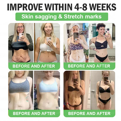 🇬🇧✨𝑪𝒍𝒊𝒏𝒊𝒄𝒂𝒍𝒍𝒚 𝑷𝒓𝒐𝒗𝒆𝒏 | 𝑶𝒇𝒇𝒊𝒄𝒊𝒂𝒍 𝑺𝒕𝒐𝒓𝒆 | 𝐓𝐡𝐨𝐧𝐞𝐬𝐫® & 𝐆𝐋𝐏-𝟏 𝑷𝒓𝒐+ 𝑶𝒓𝒂𝒍 𝑾𝒆𝒊𝒈𝒉𝒕 𝑳𝒐𝒔𝒔  𝑺𝒐𝒍𝒖𝒕𝒊𝒐𝒏 𝗍𝖺𝗋𝗀𝖾𝗍𝗌 𝑡𝑢𝑏𝑏𝑜𝑟𝑛 𝑤𝑒𝑖𝑔ℎ𝑡, ℎ𝑖𝑔ℎ 𝑏𝑙𝑜𝑜𝑑 𝑝𝑟𝑒𝑠𝑠𝑢𝑟𝑒, 𝑏𝑙𝑜𝑜𝑑 𝑠𝑢𝑔𝑎𝑟 ,𝘧𝘢𝘵𝘵𝘺 𝘭𝘪𝘷𝘦𝘳, 𝑠𝑎𝑔𝑔𝑖𝑛𝑔 𝑠𝑘𝑖𝑛 & 𝑚𝑜𝑟𝑒 𝑓𝑜𝑟 𝑏𝑒𝑡𝑡𝑒𝑟 ℎ𝑒𝑎𝑙𝑡ℎ & 𝑣𝑖𝑡𝑎𝑙𝑖𝑡𝑦💕💕