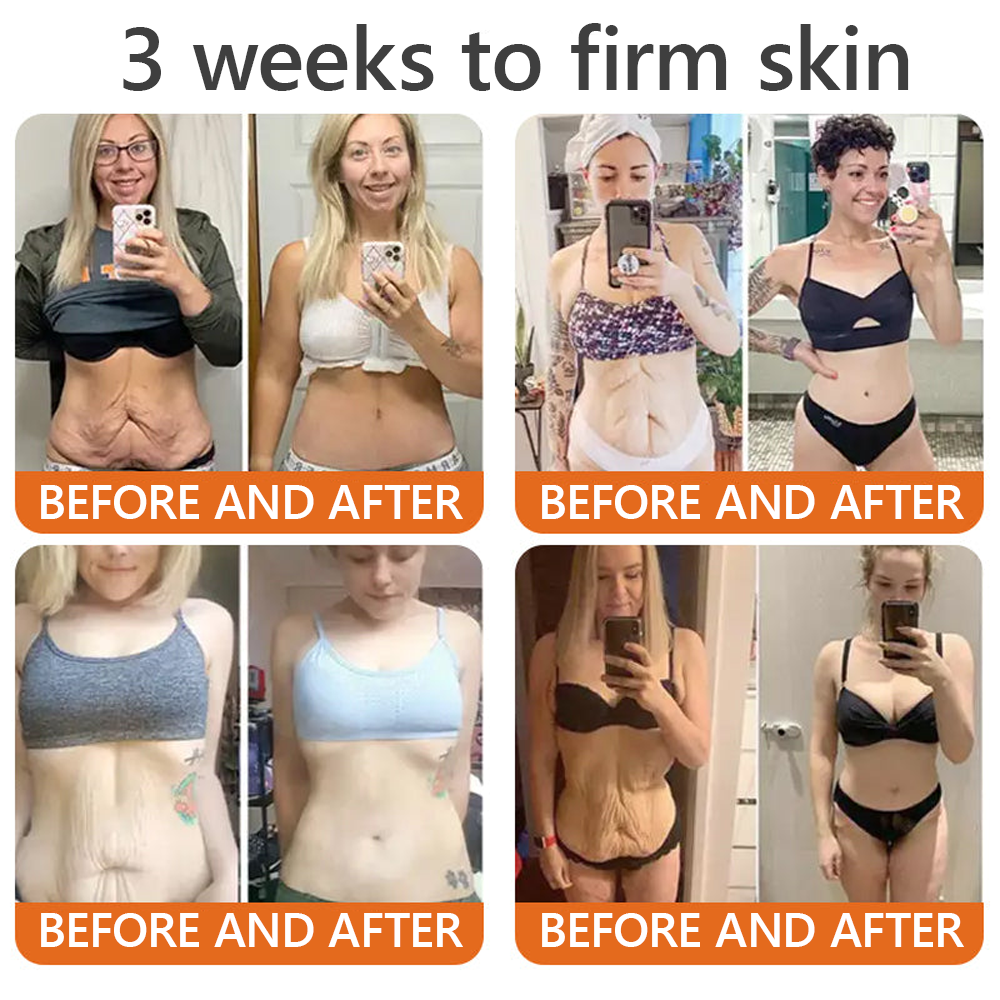 𝑶𝒇𝒇𝒊𝒄𝒊𝒂𝒍 𝑺𝒕𝒐𝒓𝒆✅ EQVP® 𝘽𝙀𝙀 𝙑𝙀𝙉𝙊𝙈 𝑺𝒌𝒊𝒏 𝑹𝒆𝒔𝒕𝒐𝒓𝒂𝒕𝒊𝒐𝒏 𝑪𝒓𝒆𝒂𝒎 –👩🏻‍⚕️ Anti-aging,Hydrating, Skin Repair, Even Tone, Acne and Dark Spot Treatment, Wart and Mole Removal, Psoriasis Relief