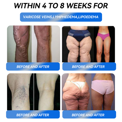 𝑶𝒇𝒇𝒊𝒄𝒊𝒂𝒍 𝑺𝒕𝒐𝒓𝒆 |𝑻𝒉𝒐𝒏𝒆𝒔𝒓® 🇬🇧  𝑮𝒍𝒑-1 𝑷𝒓𝒐 𝑺𝒊𝒙-𝒊𝒏-𝒐𝒏𝒆 𝑺𝒍𝒊𝒎𝒎𝒊𝒏𝒈 & 𝑯𝒆𝒂𝒍𝒕𝒉 𝑾𝒆𝒊𝒈𝒉𝒕 𝑳𝒐𝒔𝒔 𝑶𝒓𝒂𝒍 𝑺𝒐𝒍𝒖𝒕𝒊𝒐𝒏  (𝐉𝐮𝐬𝐭 𝐨𝐧𝐜𝐞 𝐚 𝐝𝐚𝐲, 𝐯𝐢𝐬𝐢𝐛𝐥𝐞 𝐜𝐡𝐚𝐧𝐠𝐞𝐬 𝐢𝐧 𝟕 𝐝𝐚𝐲𝐬） ✅ 𝐅𝐨𝐫 𝐨𝐛𝐞𝐬𝐢𝐭𝐲, 𝐜𝐚𝐫𝐝𝐢𝐨𝐯𝐚𝐬𝐜𝐮𝐥𝐚𝐫 𝐡𝐞𝐚𝐥𝐭𝐡, 𝐝𝐢𝐚𝐛𝐞𝐭𝐞𝐬, 𝐬𝐥𝐞𝐞𝐩 𝐚𝐩𝐧𝐞𝐚, 𝐆𝐮𝐭 𝐇𝐞𝐚𝐥𝐭𝐡, 𝐣𝐨𝐢𝐧𝐭 𝐢𝐬𝐬𝐮𝐞𝐬, 𝐚𝐧𝐝 𝐦𝐨𝐫𝐞