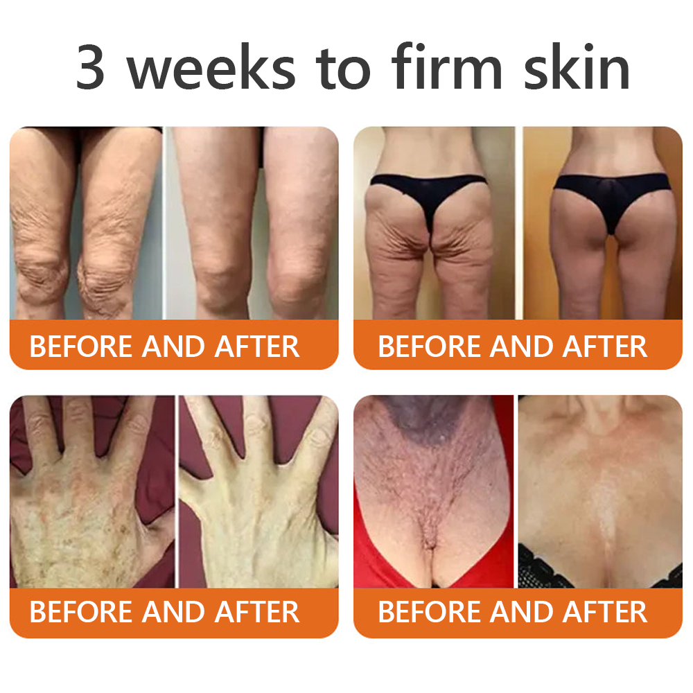 𝑶𝒇𝒇𝒊𝒄𝒊𝒂𝒍 𝑺𝒕𝒐𝒓𝒆✅ EQVP® 𝘽𝙀𝙀 𝙑𝙀𝙉𝙊𝙈 𝑺𝒌𝒊𝒏 𝑹𝒆𝒔𝒕𝒐𝒓𝒂𝒕𝒊𝒐𝒏 𝑪𝒓𝒆𝒂𝒎 –👩🏻‍⚕️ Anti-aging,Hydrating, Skin Repair, Even Tone, Acne and Dark Spot Treatment, Wart and Mole Removal, Psoriasis Relief