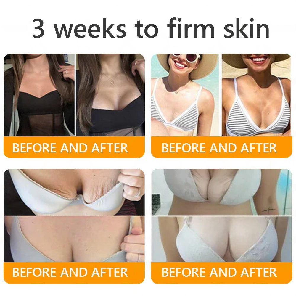 𝑶𝒇𝒇𝒊𝒄𝒊𝒂𝒍 𝑺𝒕𝒐𝒓𝒆✅ EQVP® 𝘽𝙀𝙀 𝙑𝙀𝙉𝙊𝙈 𝑺𝒌𝒊𝒏 𝑹𝒆𝒔𝒕𝒐𝒓𝒂𝒕𝒊𝒐𝒏 𝑪𝒓𝒆𝒂𝒎 –👩🏻‍⚕️ Anti-aging,Hydrating, Skin Repair, Even Tone, Acne and Dark Spot Treatment, Wart and Mole Removal, Psoriasis Relief